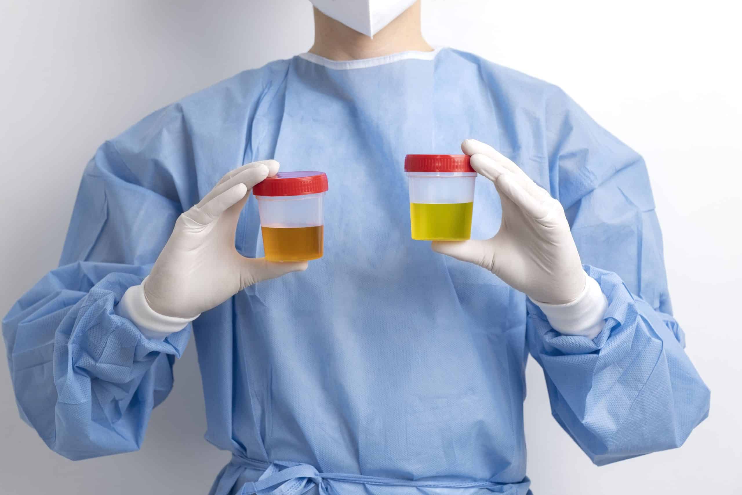 lab-doctor-performing-medical-exam-urine (2)